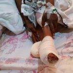 Rutshuru : 6 blessés dans l’explosion d’une bombe à Bushadara